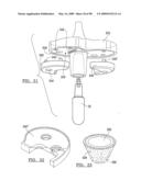 KNEE JOINT PROSTHESIS SYSTEM AND METHOD FOR IMPLANTATION diagram and image