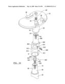 KNEE JOINT PROSTHESIS SYSTEM AND METHOD FOR IMPLANTATION diagram and image