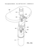 KNEE JOINT PROSTHESIS SYSTEM AND METHOD FOR IMPLANTATION diagram and image