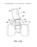 KNEE JOINT PROSTHESIS SYSTEM AND METHOD FOR IMPLANTATION diagram and image