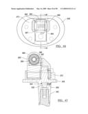 KNEE JOINT PROSTHESIS SYSTEM AND METHOD FOR IMPLANTATION diagram and image