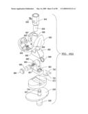 KNEE JOINT PROSTHESIS SYSTEM AND METHOD FOR IMPLANTATION diagram and image