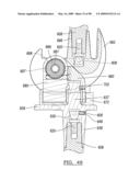 KNEE JOINT PROSTHESIS SYSTEM AND METHOD FOR IMPLANTATION diagram and image