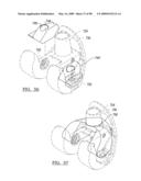 KNEE JOINT PROSTHESIS SYSTEM AND METHOD FOR IMPLANTATION diagram and image