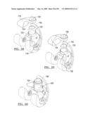 KNEE JOINT PROSTHESIS SYSTEM AND METHOD FOR IMPLANTATION diagram and image