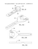 KNEE JOINT PROSTHESIS SYSTEM AND METHOD FOR IMPLANTATION diagram and image