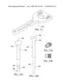 KNEE JOINT PROSTHESIS SYSTEM AND METHOD FOR IMPLANTATION diagram and image