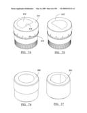 KNEE JOINT PROSTHESIS SYSTEM AND METHOD FOR IMPLANTATION diagram and image