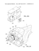 KNEE JOINT PROSTHESIS SYSTEM AND METHOD FOR IMPLANTATION diagram and image