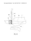 KNEE JOINT PROSTHESIS SYSTEM AND METHOD FOR IMPLANTATION diagram and image