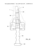 KNEE JOINT PROSTHESIS SYSTEM AND METHOD FOR IMPLANTATION diagram and image