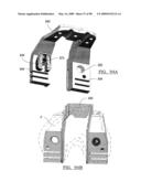 KNEE JOINT PROSTHESIS SYSTEM AND METHOD FOR IMPLANTATION diagram and image