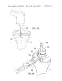 KNEE JOINT PROSTHESIS SYSTEM AND METHOD FOR IMPLANTATION diagram and image