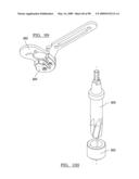 KNEE JOINT PROSTHESIS SYSTEM AND METHOD FOR IMPLANTATION diagram and image