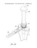 KNEE JOINT PROSTHESIS SYSTEM AND METHOD FOR IMPLANTATION diagram and image