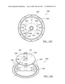 KNEE JOINT PROSTHESIS SYSTEM AND METHOD FOR IMPLANTATION diagram and image