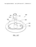 KNEE JOINT PROSTHESIS SYSTEM AND METHOD FOR IMPLANTATION diagram and image