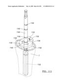 KNEE JOINT PROSTHESIS SYSTEM AND METHOD FOR IMPLANTATION diagram and image