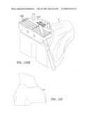 KNEE JOINT PROSTHESIS SYSTEM AND METHOD FOR IMPLANTATION diagram and image