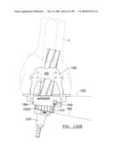 KNEE JOINT PROSTHESIS SYSTEM AND METHOD FOR IMPLANTATION diagram and image