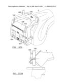 KNEE JOINT PROSTHESIS SYSTEM AND METHOD FOR IMPLANTATION diagram and image