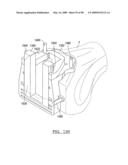 KNEE JOINT PROSTHESIS SYSTEM AND METHOD FOR IMPLANTATION diagram and image