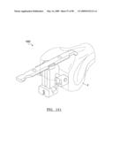 KNEE JOINT PROSTHESIS SYSTEM AND METHOD FOR IMPLANTATION diagram and image