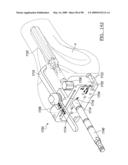 KNEE JOINT PROSTHESIS SYSTEM AND METHOD FOR IMPLANTATION diagram and image