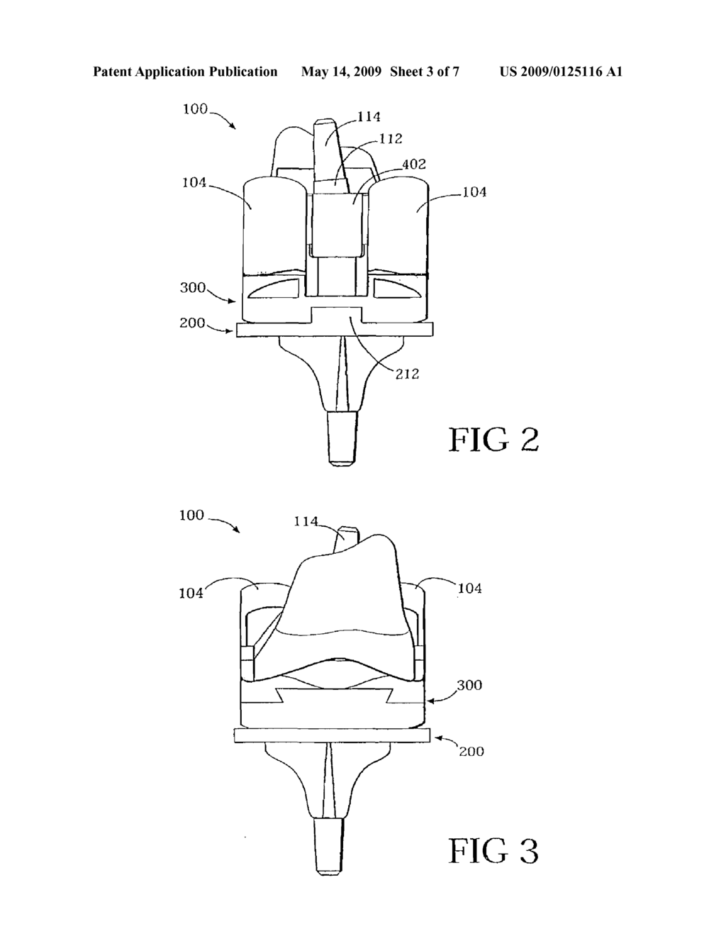 HINGED JOINT SYSTEM - diagram, schematic, and image 04