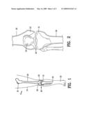 Apparatus and method for identifying the original femorotibial joint location in a revision knee replacement diagram and image