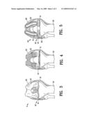 Apparatus and method for identifying the original femorotibial joint location in a revision knee replacement diagram and image