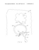 Toy-Holding Baby Garment diagram and image