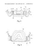 Interchangeable Mask Assembly diagram and image