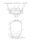 Interchangeable Mask Assembly diagram and image