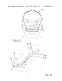 Interchangeable Mask Assembly diagram and image