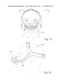 Interchangeable Mask Assembly diagram and image