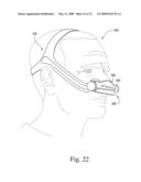 Interchangeable Mask Assembly diagram and image