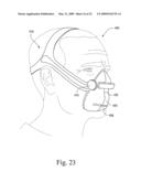 Interchangeable Mask Assembly diagram and image