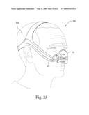 Interchangeable Mask Assembly diagram and image