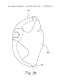 Interchangeable Mask Assembly diagram and image