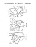 Carry-on luggage case diagram and image