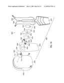 Self Stabilizing Backpack diagram and image