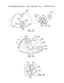 Self Stabilizing Backpack diagram and image