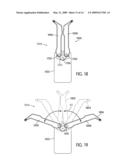 Self Stabilizing Backpack diagram and image