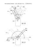 Self Stabilizing Backpack diagram and image