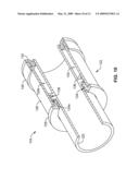 ADJUSTABLE-HEIGHT SUSPENSION SYSTEM diagram and image