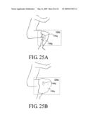 WEARABLE AIRBAG SYSTEM AND METHOD diagram and image