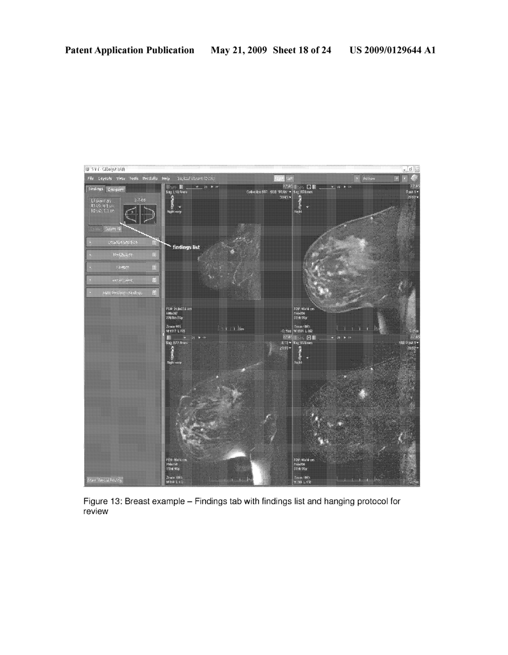 SYSTEM AND METHOD FOR EFFICIENT WORKFLOW IN READING MEDICAL IMAGE DATA - diagram, schematic, and image 19