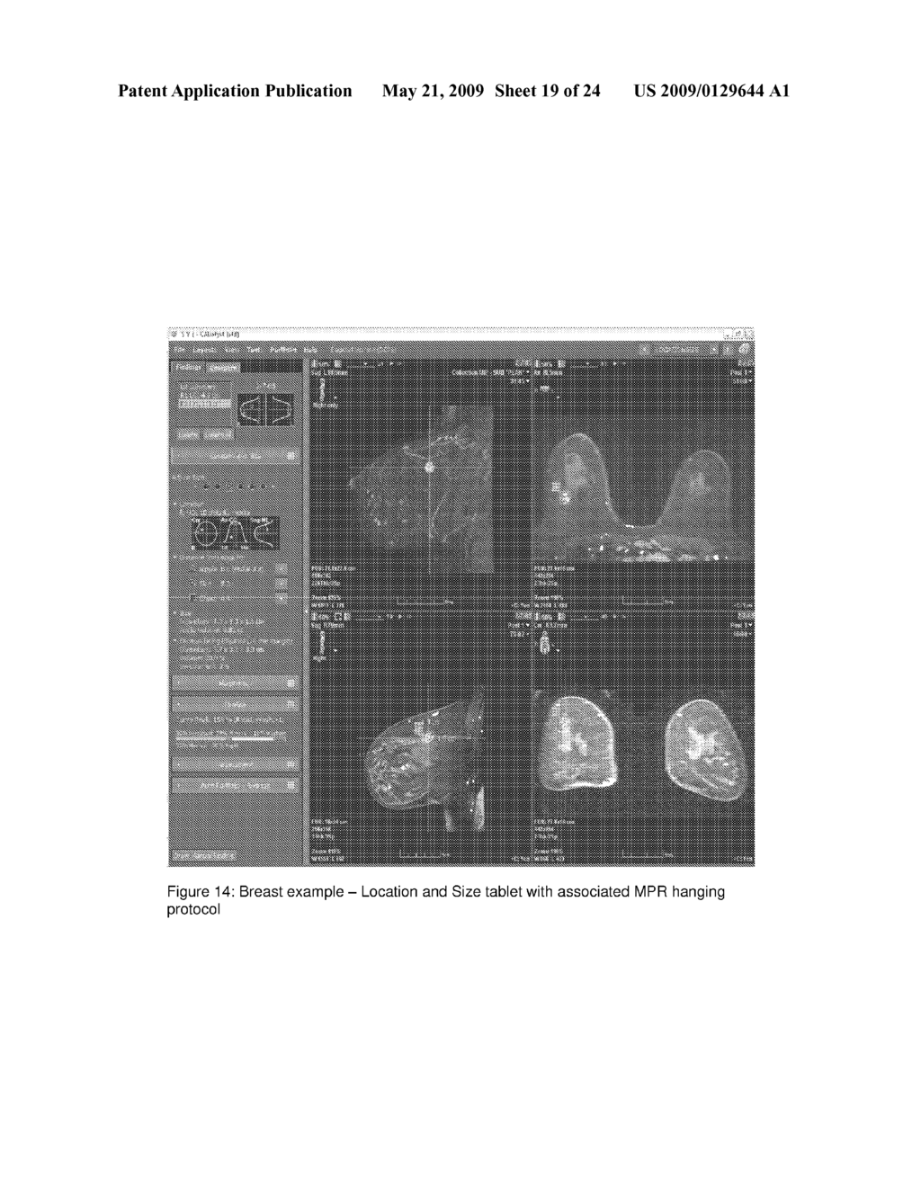 SYSTEM AND METHOD FOR EFFICIENT WORKFLOW IN READING MEDICAL IMAGE DATA - diagram, schematic, and image 20