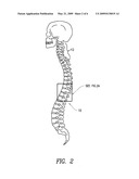 Methods of perispinal extrathecal administration of large molecules for diagnostic use in mammals diagram and image